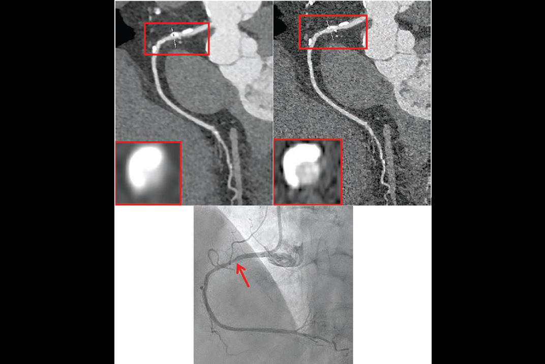 2025 07 03 Ajr Wang Figure Thumbnail