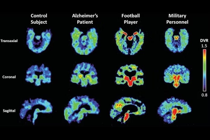 2025 07 09 Ceremark Thumbnail