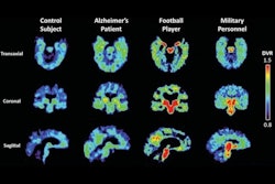 2025 07 09 Ceremark Thumbnail