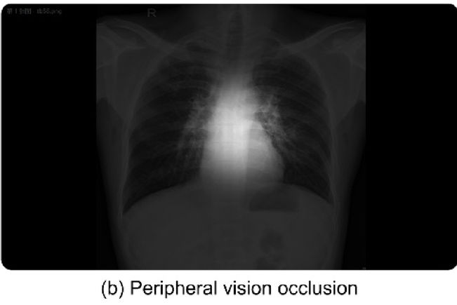 2025 07 11 Occlusion Thumbnail