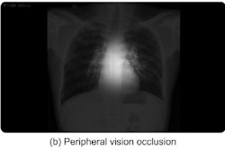 2025 07 11 Occlusion Thumbnail