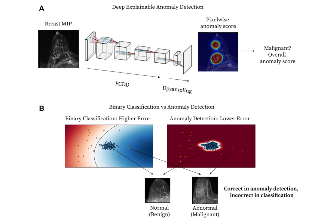 2025 07 15 Explainable Ai Model Mri