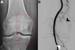 2025 07 22 Knee Gae Thumbnail