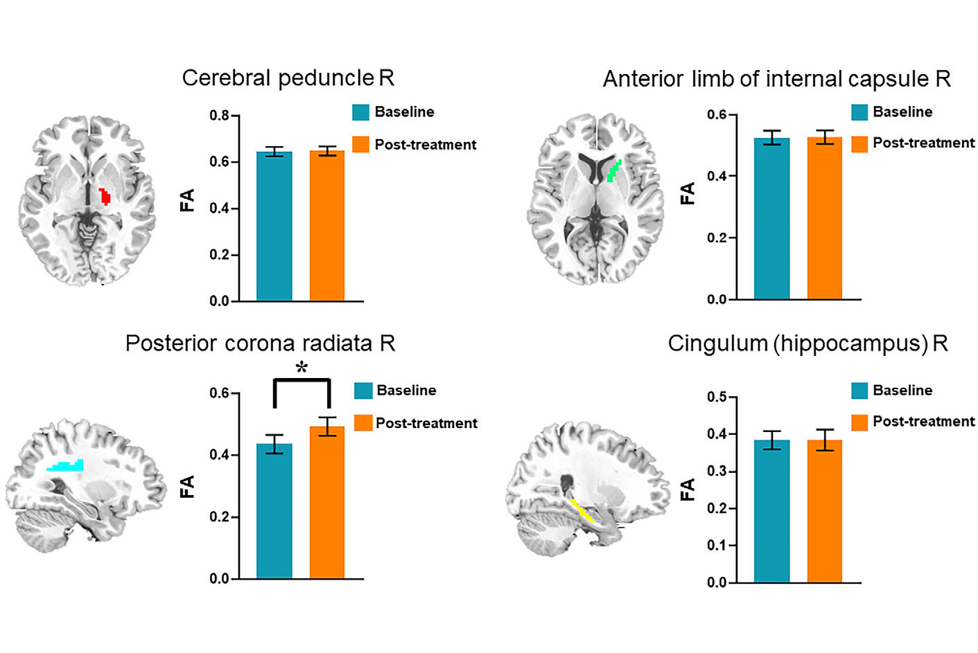 2025 07 22 Radiology Wang Figure4 Thumbnail