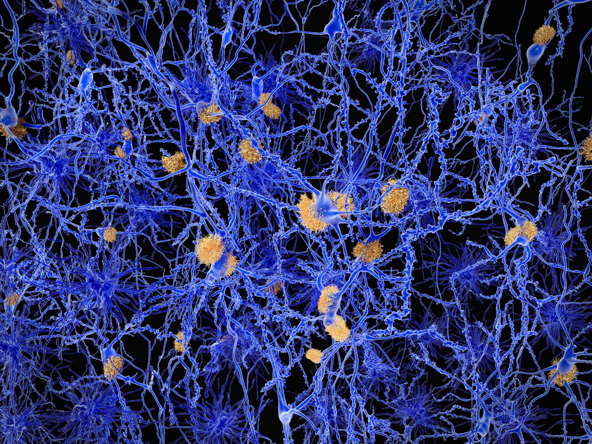 Data transparency is lacking for FDA-cleared Alzheimer’s AI technology Data transparency is lacking for FDA-cleared Alzheimer’s AI technology