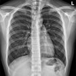 Chest X Ray Adobe Stock 567204893