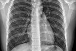 Chest X Ray Adobe Stock 567204893