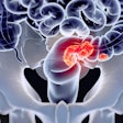 Colorectal Cancer Social (2)