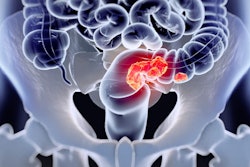 Colorectal Cancer Social (2)