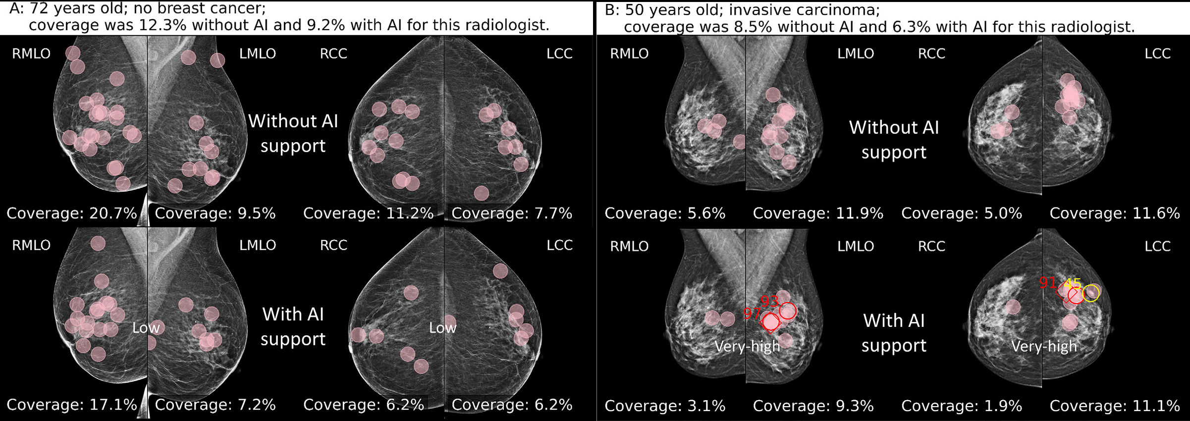 Diagnostic Breast Imaging 第2版 41FGg9FswVL._AC_SY200_QL15_.jpg