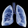 Lung Illustration Blue 400