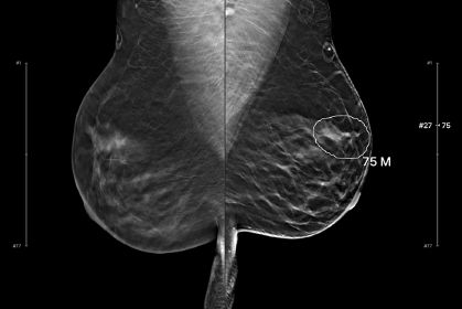 Screenshot 2025 07 28 114511 en Xl84 Vgek Thumbnail