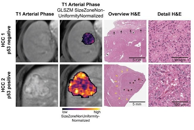 2025 08 05 Mri Molecular Profiles Thumbnail