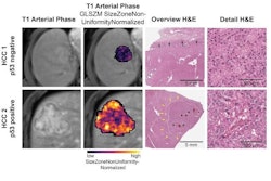 2025 08 05 Mri Molecular Profiles Thumbnail