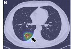 2025 08 05 Radiology Lee Figure3 Thumbnail