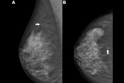 2025 08 12 Rsna Ai Mammography Challenge Thumbnail