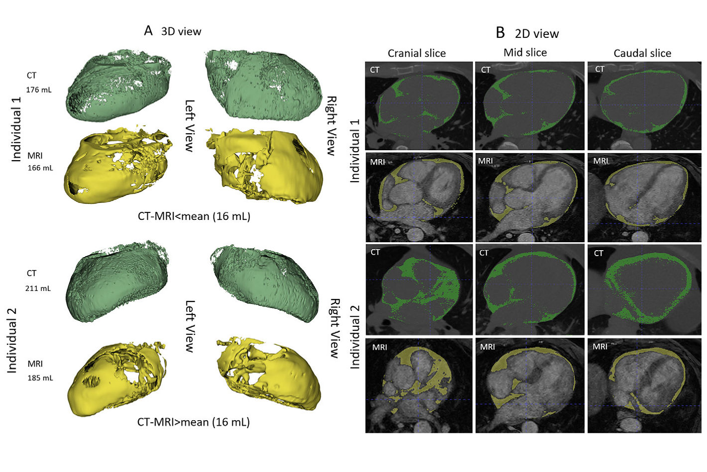 2025 08 14 Rad Cardiothor Firouznia Fig1 Thumbnail