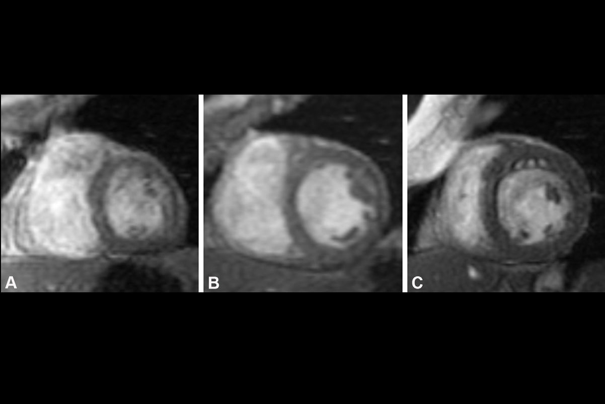 2025 08 19 Ajr Hoballah Fig1 Thumbnail