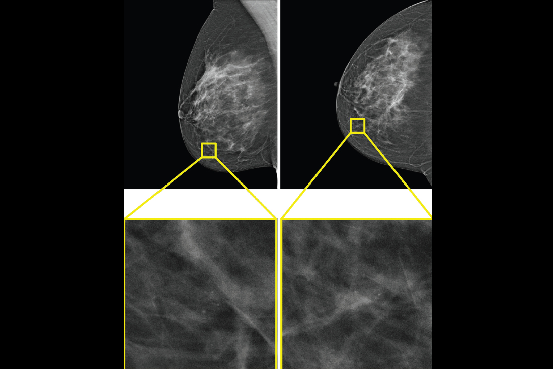 2025 08 19 Hybrid Ai Model Thumbnail