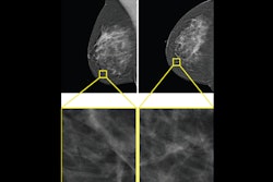 2025 08 19 Hybrid Ai Model Thumbnail