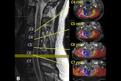 2025 08 26 Nerve Injury Thumbnail