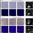 2025 08 26 Radiology Mri Tumor Shrinkage Model Thumbnail