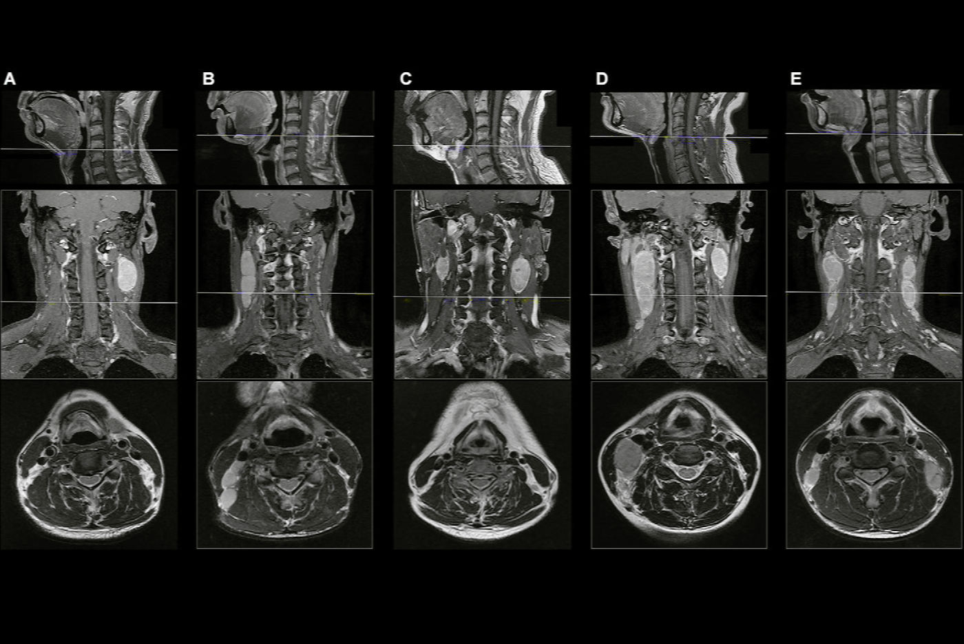 2025 08 26 Radiology Qin Fig2 Thumbnail