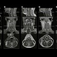 2025 08 26 Radiology Qin Fig2 Thumbnail