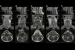 2025 08 26 Radiology Qin Fig2 Thumbnail