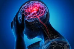 Brain Stroke Stroke