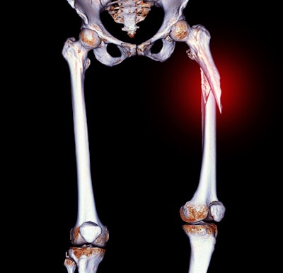 Ct Scan Pelvic Bone Adobe Samunella