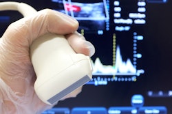 Ultrasound Probe Vascular