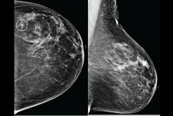 2025 09 03 Ajr Ai Breast Images Thumbnail