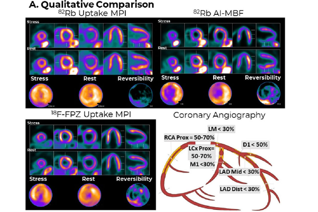 2025 09 08 Mpi Ai Thumbnail