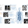 2025 09 09 Generalist Radiology Ai Six Diagnoses Thumbnail