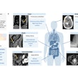 2025 09 09 Generalist Radiology Ai Six Diagnoses Thumbnail