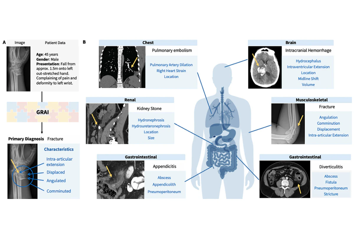 Generalist Radiology AI Framework - Experts Propose New Approach ...