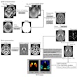 2025 09 09 Radiology Li Figure2 Thumbnail