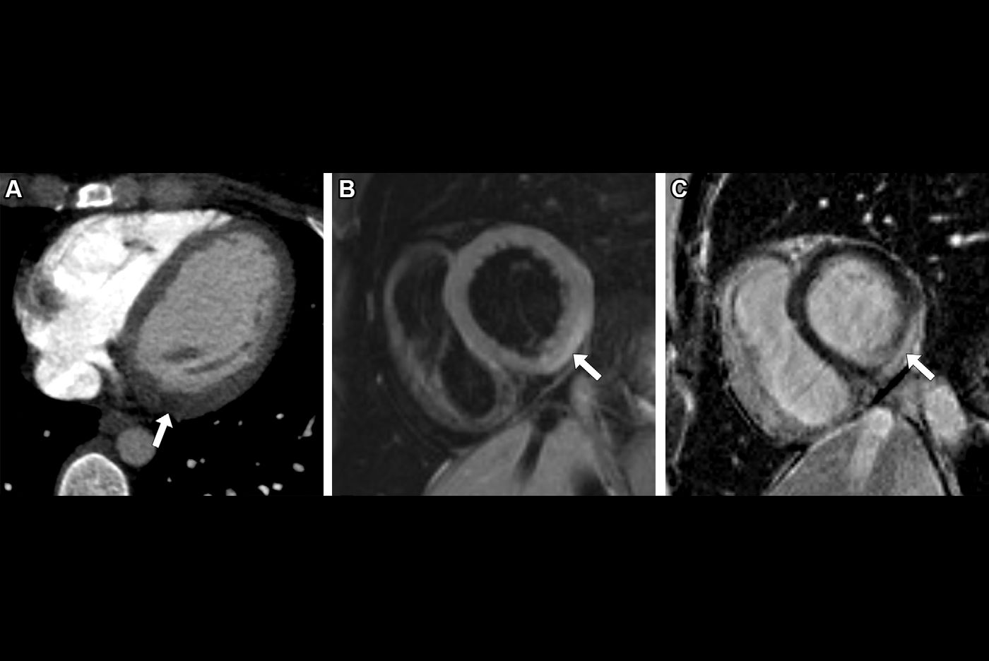 2025 09 11 Radiology Cadour Figure10 Thumbnail