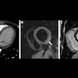 2025 09 11 Radiology Cadour Figure10 Thumbnail