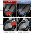 2025 09 16 Ami Mace Study Radiology Thumbnail
