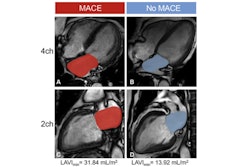 2025 09 16 Ami Mace Study Radiology Thumbnail