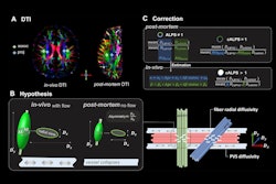 2025 09 16 Dti Alps Measurement Alzheimers Disease Fig2 Thumbnail