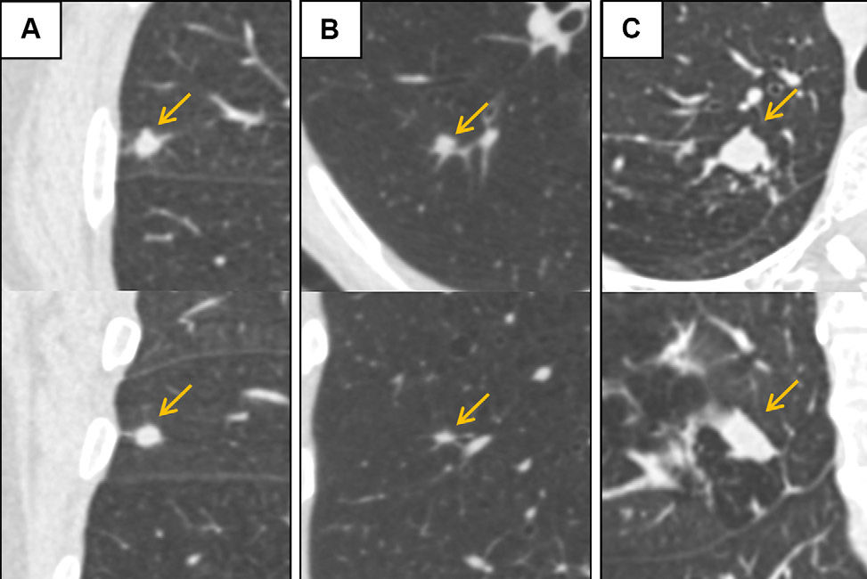 2025 09 16 Radiology Antonissen Fig4 Thumbnail