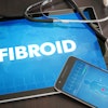 Fibroid