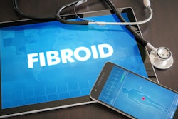 Fibroid
