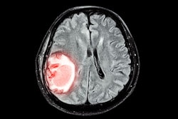 Mri Brain Disease2 Thumbnail