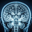 Mri Scan Brain