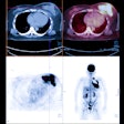 Pet Scan Thumbnail