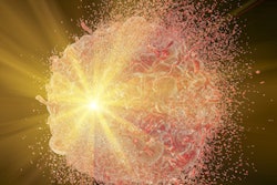 Radiotherapy2 400